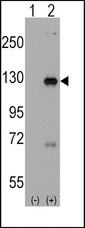 DAAM1 Antibody - Western blot of DAAM1 (arrow) using rabbit polyclonal DAAM1 Antibody(Human C-term). 293 cell lysates (2 ug/lane) either nontransfected (Lane 1) or transiently transfected with the DAAM1 gene (Lane 2) (Origene Technologies).