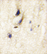 DAAM1 Antibody - Formalin-fixed and paraffin-embedded human brain tissue reacted with DAAM1 Antibody , which was peroxidase-conjugated to the secondary antibody, followed by DAB staining. This data demonstrates the use of this antibody for immunohistochemistry; clinical relevance has not been evaluated.