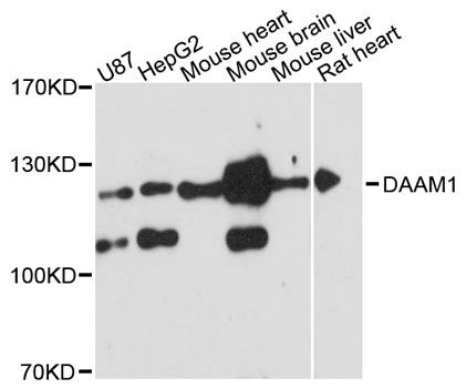 DAAM1 Antibody - Western blot analysis of extracts of various cell lines, using DAAM1 antibody at 1:3000 dilution. The secondary antibody used was an HRP Goat Anti-Rabbit IgG (H+L) at 1:10000 dilution. Lysates were loaded 25ug per lane and 3% nonfat dry milk in TBST was used for blocking. An ECL Kit was used for detection and the exposure time was 90s.