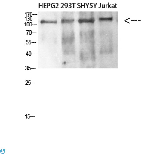 DAAM1 Antibody - Western blot analysis of HEPG2, 293T, SHY5Y and Jurkat lysate, antibody was diluted at 500. Secondary antibody was diluted at 1:20000.