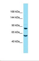 DAAM2 Antibody - Western blot of Mouse Heart. Daam2 antibody dilution 1.0 ug/ml.  This image was taken for the unconjugated form of this product. Other forms have not been tested.