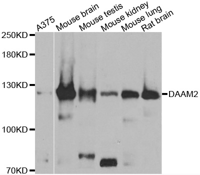 DAAM2 Antibody - Western blot analysis of extracts of various cell lines.