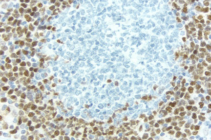 Product - Lymph Node: With pH 9.0 Antigen Unmasking Solution, Cyclin D1 (rm), ImmPRESS™ Anti-Rabbit Ig Kit, DAB (brown) substrate. Hematoxylin QS (blue) counterstain.