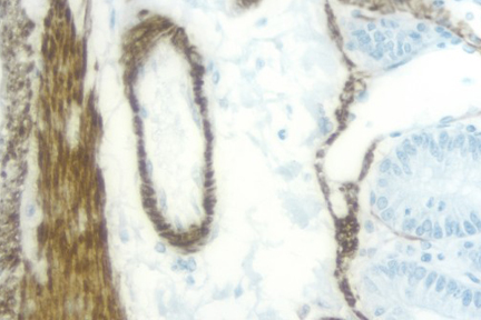 Product - Rat Intestine: Desmin (m), ImmPRESS™ Anti-Mouse Ig Kit (Rat Adsorbed), DAB (brown) Substrate Kit. Hematoxylin QS (blue) counterstain.