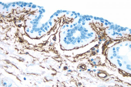 Product - Breast: CD34 (m), ImmPRESS™ Anti-Mouse Ig Kit, DAB Substrate Kit (brown). Hematoxylin counterstain (blue).