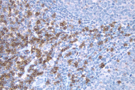 Product - Tonsil: CD8 (m), ImmPRESS™ Anti-Mouse Ig Kit, DAB Substrate Kit (brown). Hematoxylin QS counterstain (blue).