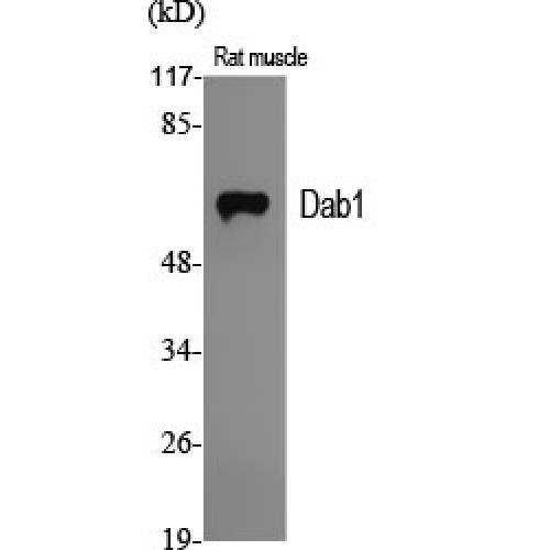 DAB1 Antibody - Western blot of Dab1 antibody