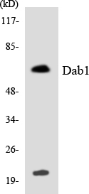 DAB1 Antibody - Western blot analysis of the lysates from RAW264.7cells using Dab1 antibody.