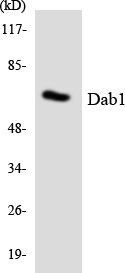 DAB1 Antibody - Western blot analysis of the lysates from HT-29 cells using Dab1 antibody.