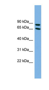 DAB1 Antibody - DAB1 antibody Western blot of THP-1 cell lysate. This image was taken for the unconjugated form of this product. Other forms have not been tested.