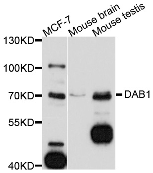 DAB1 Antibody - Western blot analysis of extracts of various cell lines, using DAB1 antibody at 1:1000 dilution. The secondary antibody used was an HRP Goat Anti-Rabbit IgG (H+L) at 1:10000 dilution. Lysates were loaded 25ug per lane and 3% nonfat dry milk in TBST was used for blocking. An ECL Kit was used for detection and the exposure time was 90s.