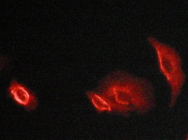 DAB1 Antibody - Staining HeLa cells by IF/ICC. The samples were fixed with PFA and permeabilized in 0.1% saponin prior to blocking in 10% serum for 45 min at 37°C. The primary antibody was diluted 1/400 and incubated with the sample for 1 hour at 37°C. A Alexa Fluor® 594 conjugated goat polyclonal to rabbit IgG (H+L), diluted 1/600 was used as secondary antibody.