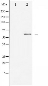 DAB1 Antibody - Western blot analysis of Dab1 expression in HepG2 whole cells lysates. The lane on the left is treated with the antigen-specific peptide.