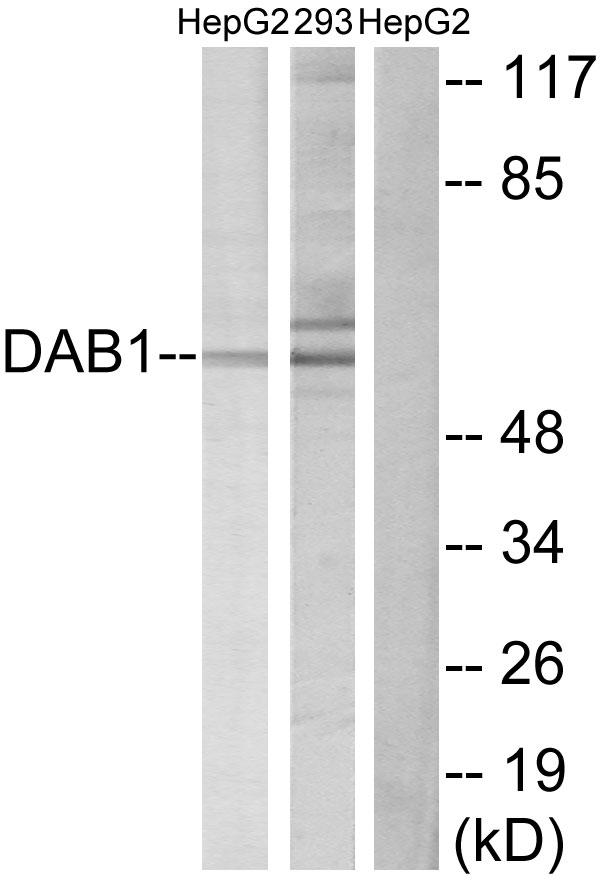 DAB1 Antibody - Western blot analysis of extracts from HepG2 cells and 293 cells, using Dab1 (Ab-232) antibody.