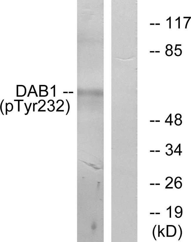 DAB1 Antibody - Western blot analysis of lysates from LOVO cells, using Dab1 (Phospho-Tyr232) Antibody. The lane on the right is blocked with the phospho peptide.