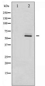 DAB1 Antibody - Western blot of Dab1 phosphorylation expression in LOVO whole cell lysates,The lane on the left is treated with the antigen-specific peptide.