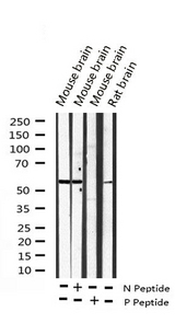 DAB1 Antibody - Western blot analysis of Phospho-Dab1 (Tyr232) expression in various lysates