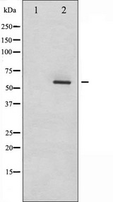 DAB1 Antibody - Western blot analysis of Dab1 phosphorylation expression in LOVO cells whole cells lysates. The lane on the left is treated with the antigen-specific peptide.
