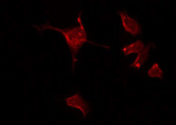 DAB1 Antibody - Staining HeLa cells by IF/ICC. The samples were fixed with PFA and permeabilized in 0.1% Triton X-100, then blocked in 10% serum for 45 min at 25°C. The primary antibody was diluted at 1:200 and incubated with the sample for 1 hour at 37°C. An Alexa Fluor 594 conjugated goat anti-rabbit IgG (H+L) Ab, diluted at 1/600, was used as the secondary antibody.