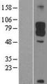 DAB1 Protein - Western validation with an anti-DDK antibody * L: Control HEK293 lysate R: Over-expression lysate