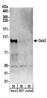 DAB2 Antibody - Detection of Human Dab2 by Western Blot. Samples: Whole cell lysate (50 ug) from HeLa, 293T, and Jurkat cells. Antibodies: Affinity purified rabbit anti-Dab2 antibody used for WB at 0.4 ug/ml. Detection: Chemiluminescence with an exposure time of 30 seconds.