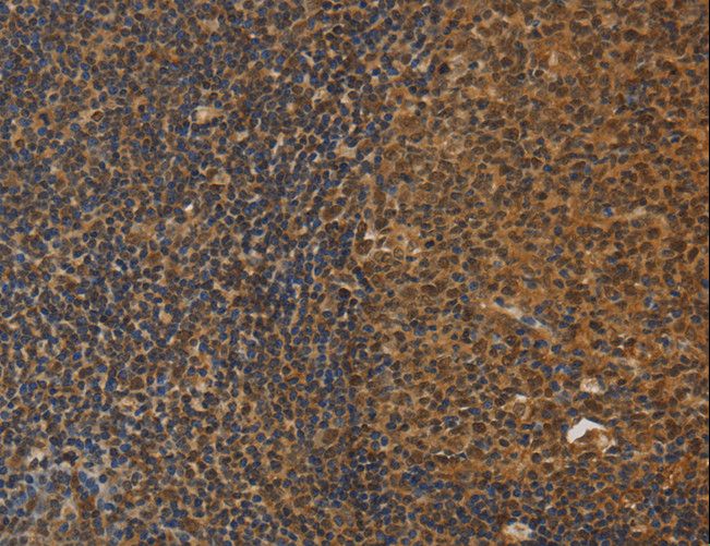 DAB2 Antibody - Immunohistochemistry of paraffin-embedded Human tonsil using DAB2 Polyclonal Antibody at dilution of 1:30.