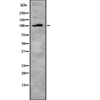 DAB2 Antibody - Western blot analysis of DAB2 using Jurkat whole lysates.