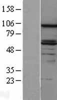 DAB2 Protein - Western validation with an anti-DDK antibody * L: Control HEK293 lysate R: Over-expression lysate