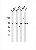 DAB2IP Antibody - All lanes: Anti-DAB2IP Antibody at 1:1000 dilution. Lane 1: Du145 whole cell lysate. Lane 2: HepG2 whole cell lysate. Lane 3: mouse brain lysate. Lane 4: HeLa whole cell lysate Lysates/proteins at 20 ug per lane. Secondary Goat Anti-mouse IgG, (H+L), Peroxidase conjugated at 1:10000 dilution. Predicted band size: 132 kDa. Blocking/Dilution buffer: 5% NFDM/TBST.
