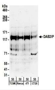 DAB2IP Antibody - Detection of Mouse DAB2IP by Western Blot. Samples: Whole cell lysate (50 ug) from TCMK-1, Renca, 4T1, and CT26.WT cells. Antibodies: Affinity purified rabbit anti-DAB2IP antibody used for WB at 0.1 ug/ml. Detection: Chemiluminescence with an exposure time of 3 minutes.