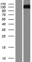 DAB2IP Protein - Western validation with an anti-DDK antibody * L: Control HEK293 lysate R: Over-expression lysate
