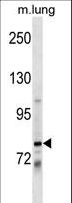 DACH / DACH1 Antibody - DACH1 Antibody western blot of mouse lung tissue lysates (35 ug/lane). The DACH1 antibody detected the DACH1 protein (arrow).