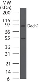 DACH / DACH1 Antibody - Western blot of Dach1 in human placenta lysate using Polyclonal Antibody to Dach1 at 5 ug/ml.