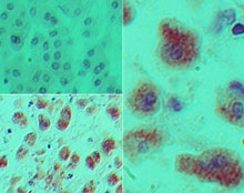 DACH / DACH1 Antibody - IHC of Dach1 in formalin-fixed, paraffin-embedded human kidney tissue using an isotype control (top left) and Polyclonal Antibody to Dach1 (bottom left, right) at 5 ug/ml.
