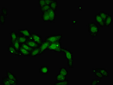 DACH / DACH1 Antibody - Immunofluorescent analysis of HepG2 cells diluted at 1:100 and Alexa Fluor 488-congugated AffiniPure Goat Anti-Rabbit IgG(H+L)