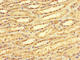 DACH / DACH1 Antibody - Immunohistochemistry of paraffin-embedded human kidney tissue at dilution of 1:100