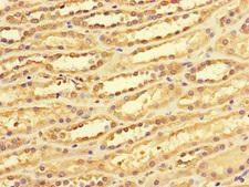 DACH / DACH1 Antibody - Immunohistochemistry of paraffin-embedded human kidney tissue at dilution of 1:100