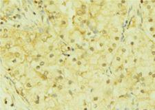 DACH / DACH1 Antibody - 1:100 staining mouse liver tissue by IHC-P. The sample was formaldehyde fixed and a heat mediated antigen retrieval step in citrate buffer was performed. The sample was then blocked and incubated with the antibody for 1.5 hours at 22°C. An HRP conjugated goat anti-rabbit antibody was used as the secondary.