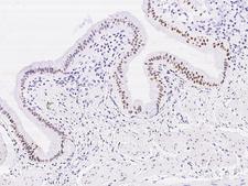 DACH / DACH1 Antibody - Immunochemical staining of human DACH1 in human gallbladder with rabbit polyclonal antibody at 1:500 dilution, formalin-fixed paraffin embedded sections.