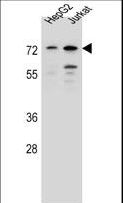DACH2 Antibody - DACH2 Antibody western blot of HepG2,Jurkat cell line lysates (35 ug/lane). The DACH2 antibody detected the DACH2 protein (arrow).