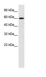 DACH2 Antibody - Jurkat Cell Lysate.  This image was taken for the unconjugated form of this product. Other forms have not been tested.