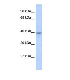 DACH2 Antibody - Western blot of Human MCF7. DACH2 antibody dilution 1.0 ug/ml.  This image was taken for the unconjugated form of this product. Other forms have not been tested.