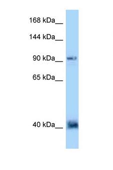 DACT1 / DAPPER Antibody - DACT1 antibody Western blot of 435S Cell lysate. Antibody concentration 1 ug/ml.  This image was taken for the unconjugated form of this product. Other forms have not been tested.