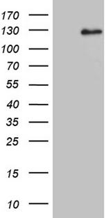 DACT1 / DAPPER Antibody - HEK293T cells were transfected with the pCMV6-ENTRY control. (Left lane) or pCMV6-ENTRY DACT1. (Right lane) cDNA for 48 hrs and lysed. Equivalent amounts of cell lysates. (5 ug per lane) were separated by SDS-PAGE and immunoblotted with anti-DACT1. (1:2000)