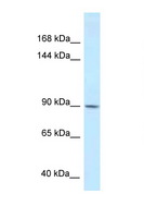 DACT1 / DAPPER Antibody - DACT1 antibody Western blot of 293T Cell lysate. Antibody concentration 1 ug/ml.  This image was taken for the unconjugated form of this product. Other forms have not been tested.