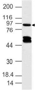 DACT1 / DAPPER Antibody - Fig-1: Western blot analysis of Dapper homolog 1. Anti-Dapper homolog 1 antibody was used at 4 µg/ml on Jurkat lysate.