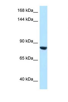 DACT1 / DAPPER Antibody - DACT1 antibody Western blot of HepG2 Cell lysate. Antibody concentration 1 ug/ml.  This image was taken for the unconjugated form of this product. Other forms have not been tested.