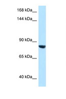 DACT1 / DAPPER Antibody - DACT1 antibody Western blot of HepG2 Cell lysate. Antibody concentration 1 ug/ml.  This image was taken for the unconjugated form of this product. Other forms have not been tested.