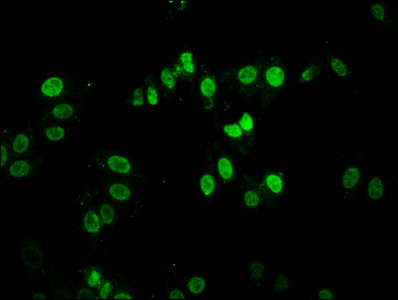 DACT1 / DAPPER Antibody - Immunofluorescence staining of HepG2 cells diluted at 1:100, counter-stained with DAPI. The cells were fixed in 4% formaldehyde, permeabilized using 0.2% Triton X-100 and blocked in 10% normal Goat Serum. The cells were then incubated with the antibody overnight at 4°C.The Secondary antibody was Alexa Fluor 488-congugated AffiniPure Goat Anti-Rabbit IgG (H+L).