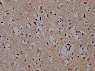 DACT1 / DAPPER Antibody - IHC image of DACT1 Antibody diluted at 1:600 and staining in paraffin-embedded human brain tissue performed on a Leica BondTM system. After dewaxing and hydration, antigen retrieval was mediated by high pressure in a citrate buffer (pH 6.0). Section was blocked with 10% normal goat serum 30min at RT. Then primary antibody (1% BSA) was incubated at 4°C overnight. The primary is detected by a biotinylated secondary antibody and visualized using an HRP conjugated SP system.